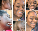 Youthful Glow Skin Care Collection