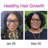 Herbal Oil Hair Growth Stimulant